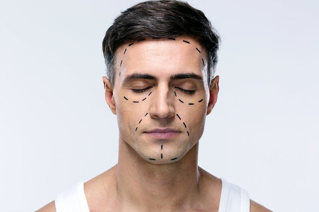 male plastic surgery