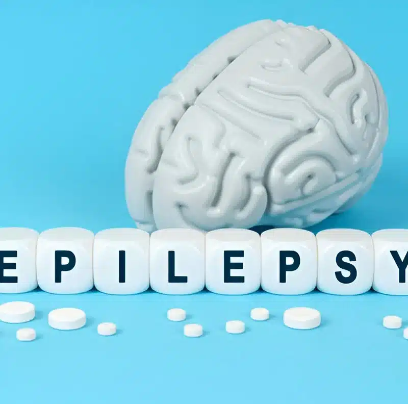 epilepsy symptos